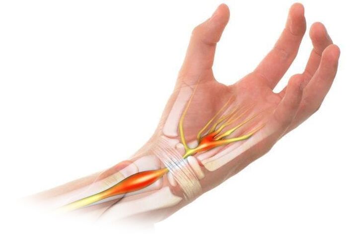 Pain with inflammation in the joints
