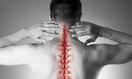 As cervical spine osteochondrosis manifests