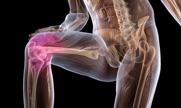Signs and symptoms of knee joint arthrosis