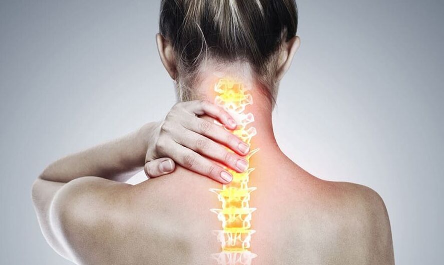 Osteochondrosis of the cervical spine